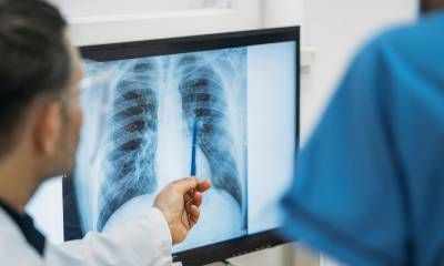 Especialistas remarcan la necesidad de detectar a tiempo el cáncer de pulmón